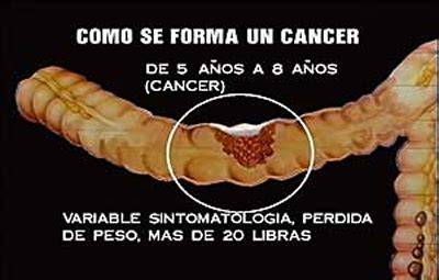 ¿Cómo se forma un cáncer?   Notas Sobre Gastroenterología Cibernética ...