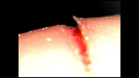 Cómo se ve una herida en un microscopio digital   YouTube