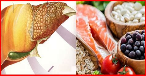 Cómo tratar y curar el hígado graso con estos 5 alimentos!