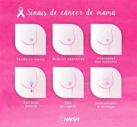 Conheça os sinais de câncer de mama – Hospital Nossa ...