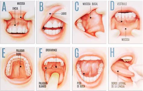 Conoce qué es el Cáncer Oral y como tratarlo   Rodium dental