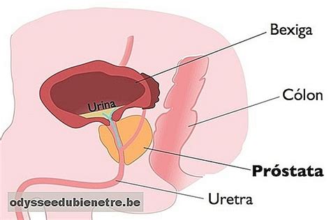 Conozca los principales síntomas y cómo curar el cáncer de próstata ...