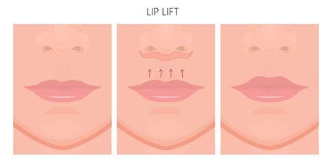 Consigue unos labios más voluminosos con la técnica Lip ...