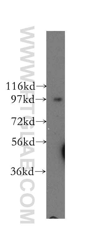 COPG Antibody 12393 1 AP | Proteintech