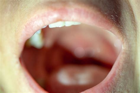 Coronavirus picor de garganta | Cosquilleo en la garganta ...