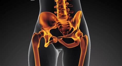 Coxartrosis  artrosis de la cadera    Netdoctor.es