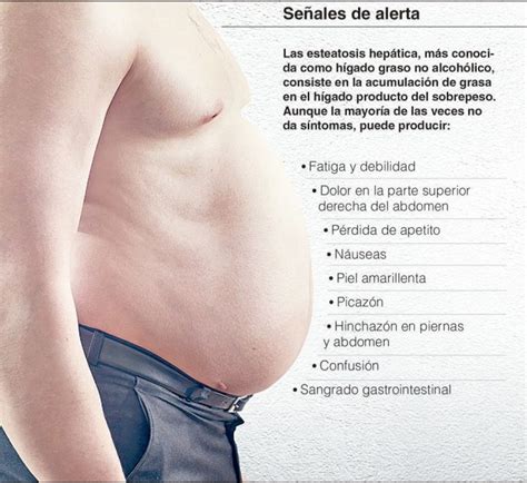 Crece 40% en México casos de hígado graso   Plumas libres