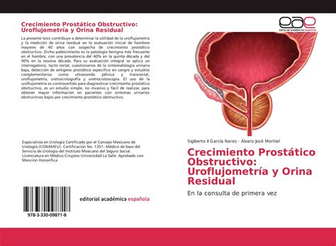 Crecimiento Prostático Obstructivo: Uroflujometría y Orina Residual ...