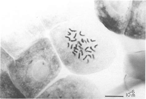 Cromosomas premetafisicos de Brunellia comocladifolia subsp ...