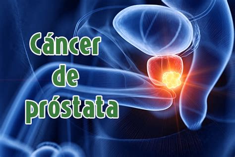 ¿Cuál es el tratamiento de cáncer de próstata? – Clínica San Rafael