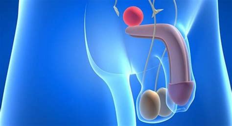 ¿Cuáles son los tratamientos para el cáncer de próstata ...