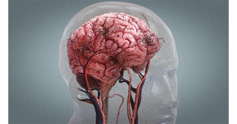 Decreased Cerebral Blood Flow | High Impact Visual ...