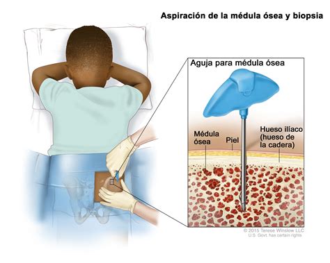 Descripción del tratamiento de tumores de encéfalo y de ...