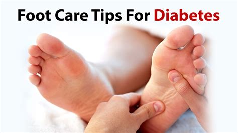 Diabetic Foot Care   CharcotFootCare