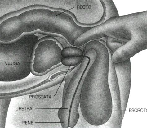 Diagnóstico de la hiperplasia benigna o adenoma de próstata