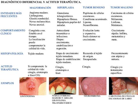 Diagnóstico diferencial de las lesiones exofíticas de los ...