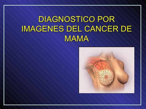 Diagnostico por imagenes del cancer de mama