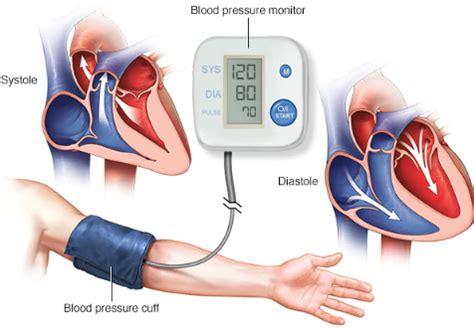 Diagnóstico y Tratamiento de la hipertensión arterial ...