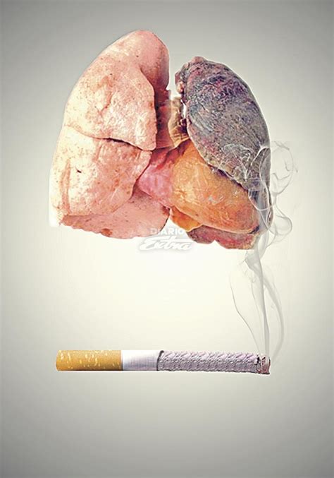 Diario Extra   Fumar le puede generar 12 tipos de cáncer