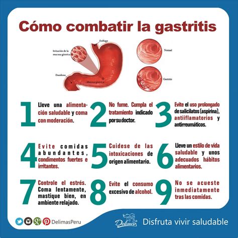 Dieta para la Gastritis | Recomendaciones alimentarias   Alimentación ...
