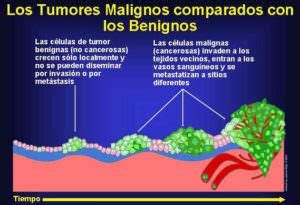 Diferencia entre tumor maligno y benigno   Diagnóstico Rojas