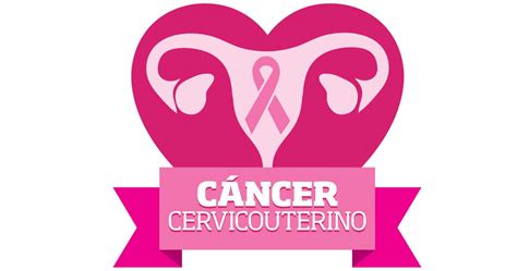 Discapaaccesible: Avances para diagnosticar el cancer cervicouterino