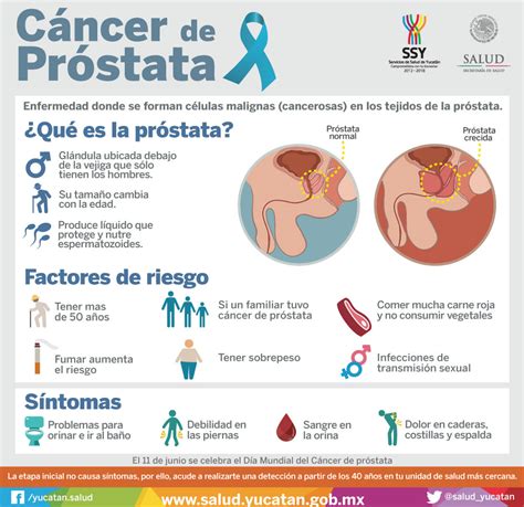 Diversos tipos de cáncer | Servicios de Salud de Yucatán