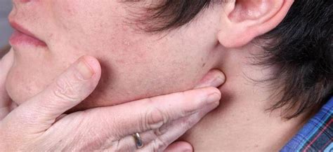 Dolor de cuello detrás de la oreja | Guía de Salud