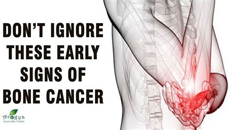 Don t ignore these early signs of bone cancer | symptoms ...