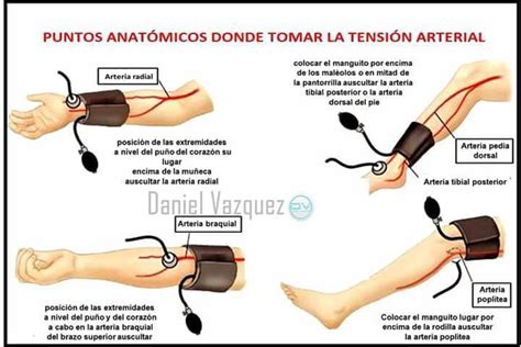 Dr. Adrián A. Torres Prado on Twitter:  Puntos anatómicos ...