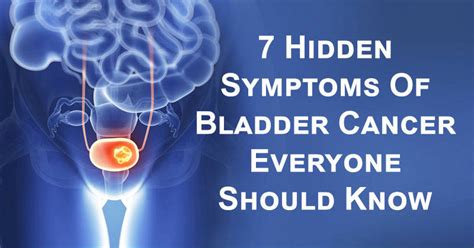 Early Detection Of Bladder Cancer? Here Are 7 Symptoms