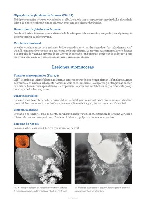 Ebook exploracion radiologica del aparato digestivo by iberoinvesa ...