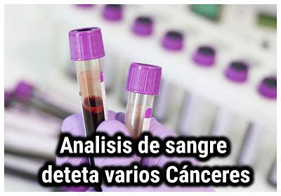 El análisis de sangre puede detectar muchos cánceres ...