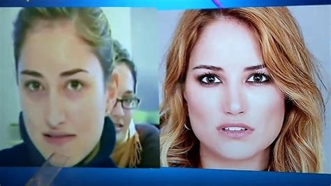 El antes y el después de Alba Carrillo: retoques en nariz, barbilla ...