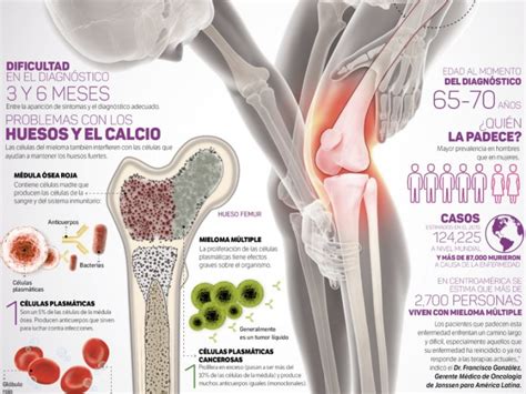 El Cáncer de huesos demanda mayor atención. MEGANOTICIAS