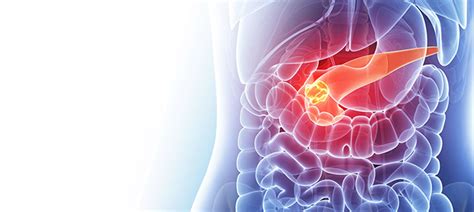 El cáncer de páncreas y el de esófago: Los tumores con la ...