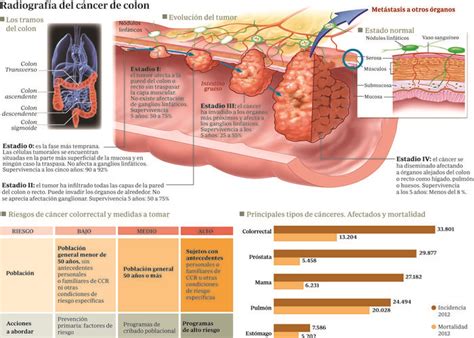 El cribado de cáncer de colon podría evitar 3.600 muertes ...
