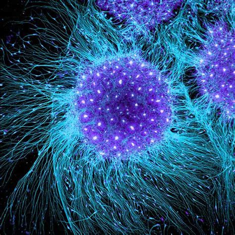 El peligro de usar células madre como tratamiento para el ...