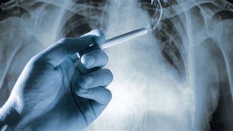 El tabaco, responsable del aumento de cáncer de pulmón en ...