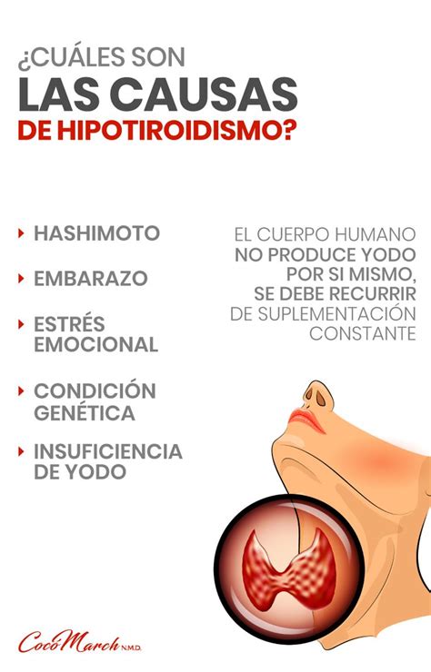 EL Yodo Naciente  Nascent Iodine  Y El Hipotiroidismo ...