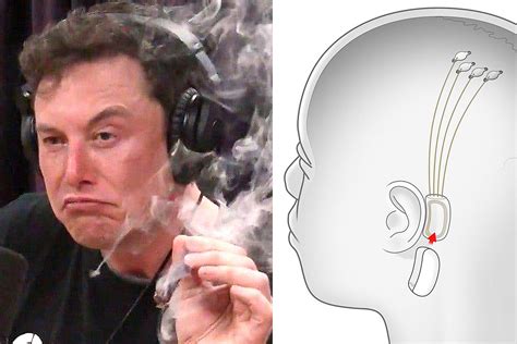Elon Musk Plans Brain Chip for Blasting Music, Killing ...