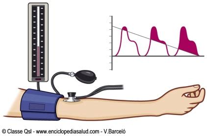Enciclopedia Salud: Cómo tomarse la tensión arterial