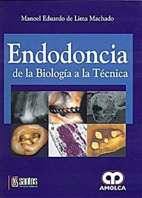 Endodoncia de la Biología a la Técnica   De Lima. Librería ...