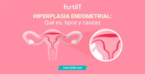 Endometrial Sintomas Y Tratamiento