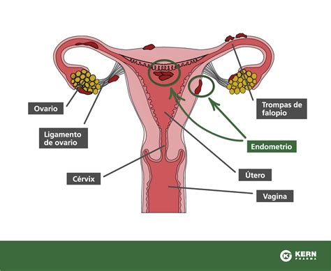 Endometriosis: cuando el ciclo menstrual se convierte en ...