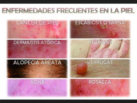 Enfermedades de la piel: definición, tipos, causas, síntomas y mucho más