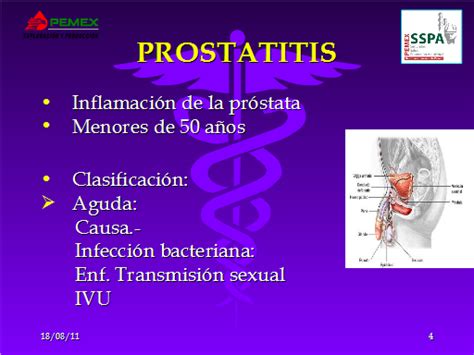 Enfermedades de la próstata   Monografias.com
