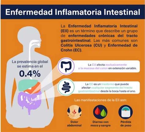 Enfermedades intestinales inflamatorias crónicas.