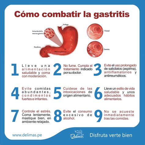 Enfermedades y su prevención: Prevención de la Gastritis