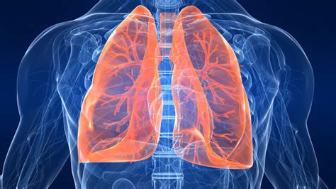 Enfisema pulmonar: síntomas, tratamiento, esperanza de ...